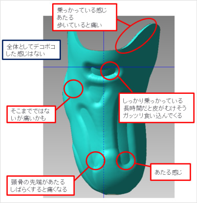 装着者の履き心地と義肢装具士の対処法ヒアリング結果